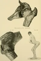 An illustration from The principles and practice of modern surgery / by Roswell Park ... with 722 engravings and 60 full-page plates in colors and monochrome. (1907)