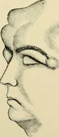 An illustration from The principles and practice of modern surgery / by Roswell Park ... with 722 engravings and 60 full-page plates in colors and monochrome. (1907)