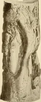 An illustration from The principles and practice of modern surgery / by Roswell Park ... with 722 engravings and 60 full-page plates in colors and monochrome. (1907)