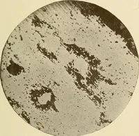An illustration from The principles and practice of modern surgery / by Roswell Park ... with 722 engravings and 60 full-page plates in colors and monochrome. (1907)