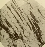 Picture 5 of 224 from The principles and practice of modern surgery / by Roswell Park ... with 722 engravings and 60 full-page plates in colors and monochrome. (1907), leaf 55