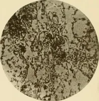 Picture 6 of 224 from The principles and practice of modern surgery / by Roswell Park ... with 722 engravings and 60 full-page plates in colors and monochrome. (1907), leaf 55