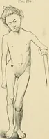 An illustration from The principles and practice of modern surgery / by Roswell Park ... with 722 engravings and 60 full-page plates in colors and monochrome. (1907)