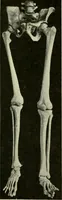 An illustration from The principles and practice of modern surgery / by Roswell Park ... with 722 engravings and 60 full-page plates in colors and monochrome. (1907)