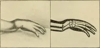 An illustration from The principles and practice of modern surgery / by Roswell Park ... with 722 engravings and 60 full-page plates in colors and monochrome. (1907)