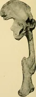 An illustration from The principles and practice of modern surgery / by Roswell Park ... with 722 engravings and 60 full-page plates in colors and monochrome. (1907)