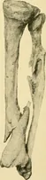 Picture 107 of 224 from The principles and practice of modern surgery / by Roswell Park ... with 722 engravings and 60 full-page plates in colors and monochrome. (1907), leaf 604