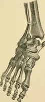 An illustration from The principles and practice of modern surgery / by Roswell Park ... with 722 engravings and 60 full-page plates in colors and monochrome. (1907)