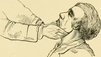An illustration from The principles and practice of modern surgery / by Roswell Park ... with 722 engravings and 60 full-page plates in colors and monochrome. (1907)
