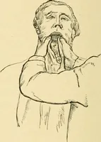 An illustration from The principles and practice of modern surgery / by Roswell Park ... with 722 engravings and 60 full-page plates in colors and monochrome. (1907)