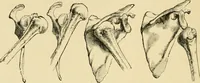 An illustration from The principles and practice of modern surgery / by Roswell Park ... with 722 engravings and 60 full-page plates in colors and monochrome. (1907)