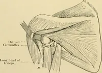 An illustration from The principles and practice of modern surgery / by Roswell Park ... with 722 engravings and 60 full-page plates in colors and monochrome. (1907)