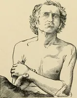 An illustration from The principles and practice of modern surgery / by Roswell Park ... with 722 engravings and 60 full-page plates in colors and monochrome. (1907)