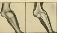 An illustration from The principles and practice of modern surgery / by Roswell Park ... with 722 engravings and 60 full-page plates in colors and monochrome. (1907)