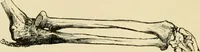 An illustration from The principles and practice of modern surgery / by Roswell Park ... with 722 engravings and 60 full-page plates in colors and monochrome. (1907)