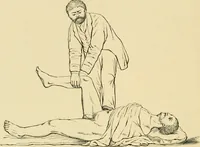 An illustration from The principles and practice of modern surgery / by Roswell Park ... with 722 engravings and 60 full-page plates in colors and monochrome. (1907)