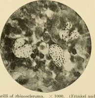 Picture 9 of 224 from The principles and practice of modern surgery / by Roswell Park ... with 722 engravings and 60 full-page plates in colors and monochrome. (1907), leaf 63