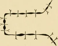 An illustration from The principles and practice of modern surgery / by Roswell Park ... with 722 engravings and 60 full-page plates in colors and monochrome. (1907)
