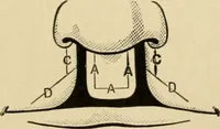 An illustration from The principles and practice of modern surgery / by Roswell Park ... with 722 engravings and 60 full-page plates in colors and monochrome. (1907)