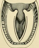 An illustration from The principles and practice of modern surgery / by Roswell Park ... with 722 engravings and 60 full-page plates in colors and monochrome. (1907)