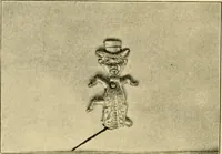 Picture 151 of 224 from The principles and practice of modern surgery / by Roswell Park ... with 722 engravings and 60 full-page plates in colors and monochrome. (1907), leaf 770