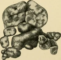 Picture 154 of 224 from The principles and practice of modern surgery / by Roswell Park ... with 722 engravings and 60 full-page plates in colors and monochrome. (1907), leaf 801
