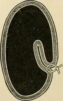 An illustration from The principles and practice of modern surgery / by Roswell Park ... with 722 engravings and 60 full-page plates in colors and monochrome. (1907)