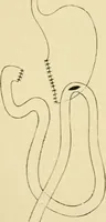 Picture 167 of 224 from The principles and practice of modern surgery / by Roswell Park ... with 722 engravings and 60 full-page plates in colors and monochrome. (1907), leaf 916