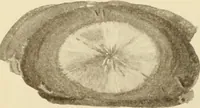 Picture 171 of 224 from The principles and practice of modern surgery / by Roswell Park ... with 722 engravings and 60 full-page plates in colors and monochrome. (1907), leaf 933