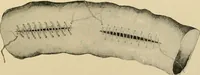 Picture 172 of 224 from The principles and practice of modern surgery / by Roswell Park ... with 722 engravings and 60 full-page plates in colors and monochrome. (1907), leaf 943