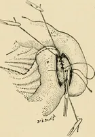 An illustration from The principles and practice of modern surgery / by Roswell Park ... with 722 engravings and 60 full-page plates in colors and monochrome. (1907)