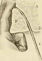 An illustration from The principles and practice of modern surgery / by Roswell Park ... with 722 engravings and 60 full-page plates in colors and monochrome. (1907)