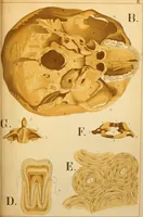 An illustration from An atlas of anatomy, or, Pictures of the human body in twenty-four quartro coloured plates comprising one hundred separate figures, with descriptive Letterpress / by Fenwick Miller. (1879)