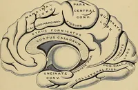 An illustration from Surgical diagnosis / by Edward Martin ... illustrated with 445 engravings and 18 plates in colors and monochrome. (1909)