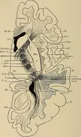 An illustration from Surgical diagnosis / by Edward Martin ... illustrated with 445 engravings and 18 plates in colors and monochrome. (1909)