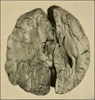 An illustration from Surgical diagnosis / by Edward Martin ... illustrated with 445 engravings and 18 plates in colors and monochrome. (1909)