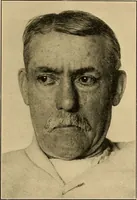 An illustration from Surgical diagnosis / by Edward Martin ... illustrated with 445 engravings and 18 plates in colors and monochrome. (1909)