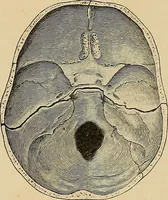 An illustration from Surgical diagnosis / by Edward Martin ... illustrated with 445 engravings and 18 plates in colors and monochrome. (1909)