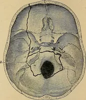 An illustration from Surgical diagnosis / by Edward Martin ... illustrated with 445 engravings and 18 plates in colors and monochrome. (1909)