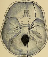 An illustration from Surgical diagnosis / by Edward Martin ... illustrated with 445 engravings and 18 plates in colors and monochrome. (1909)