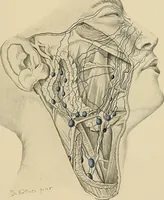 An illustration from Surgical diagnosis / by Edward Martin ... illustrated with 445 engravings and 18 plates in colors and monochrome. (1909)