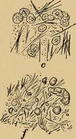 An illustration from Surgical diagnosis / by Edward Martin ... illustrated with 445 engravings and 18 plates in colors and monochrome. (1909)