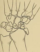 An illustration from Surgical diagnosis / by Edward Martin ... illustrated with 445 engravings and 18 plates in colors and monochrome. (1909)
