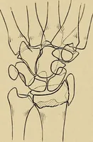 An illustration from Surgical diagnosis / by Edward Martin ... illustrated with 445 engravings and 18 plates in colors and monochrome. (1909)