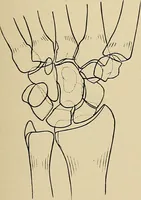 An illustration from Surgical diagnosis / by Edward Martin ... illustrated with 445 engravings and 18 plates in colors and monochrome. (1909)