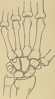 Picture 67 of 129 from Surgical diagnosis / by Edward Martin ... illustrated with 445 engravings and 18 plates in colors and monochrome. (1909), leaf 390