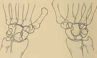 Picture 68 of 129 from Surgical diagnosis / by Edward Martin ... illustrated with 445 engravings and 18 plates in colors and monochrome. (1909), leaf 390