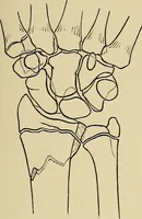 An illustration from Surgical diagnosis / by Edward Martin ... illustrated with 445 engravings and 18 plates in colors and monochrome. (1909)