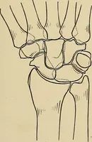 An illustration from Surgical diagnosis / by Edward Martin ... illustrated with 445 engravings and 18 plates in colors and monochrome. (1909)