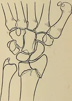 An illustration from Surgical diagnosis / by Edward Martin ... illustrated with 445 engravings and 18 plates in colors and monochrome. (1909)